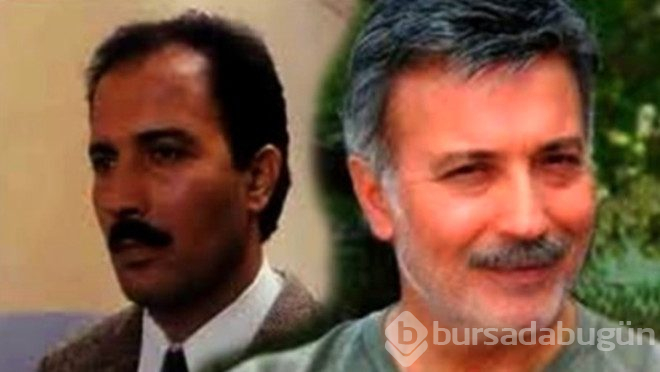 Protez saç kullanan ünlü isimler