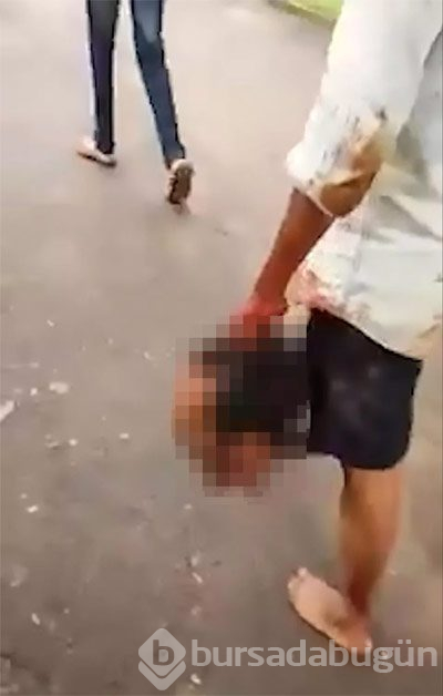 Kesik başla 20 kilometre gitti!
