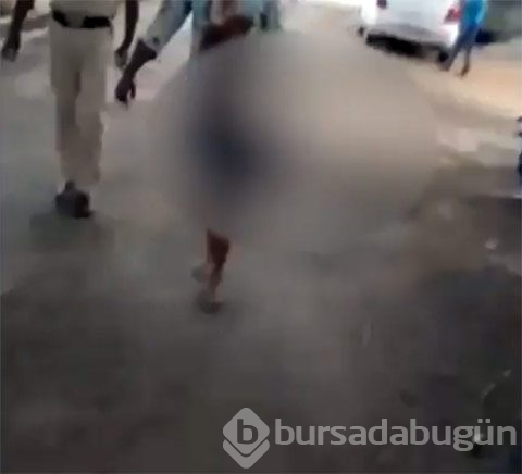 Kesik başla 20 kilometre gitti!
