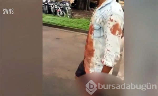 Kesik başla 20 kilometre gitti!
