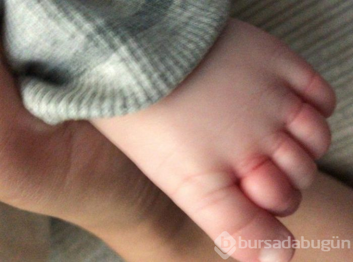Aklınıza bile gelmez! Az daha parmağından oluyordu

