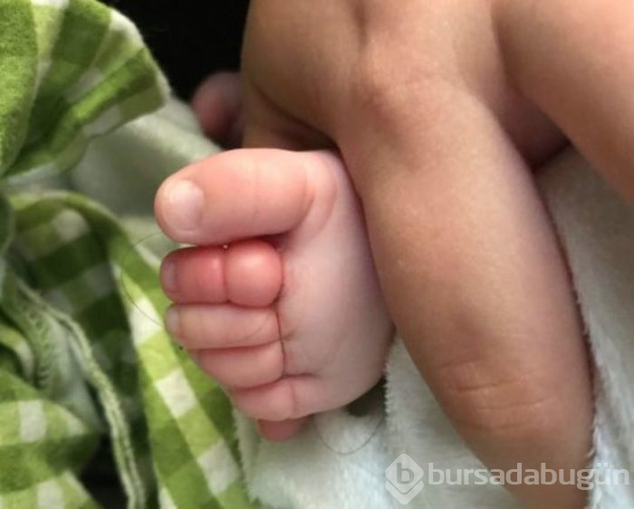 Aklınıza bile gelmez! Az daha parmağından oluyordu
