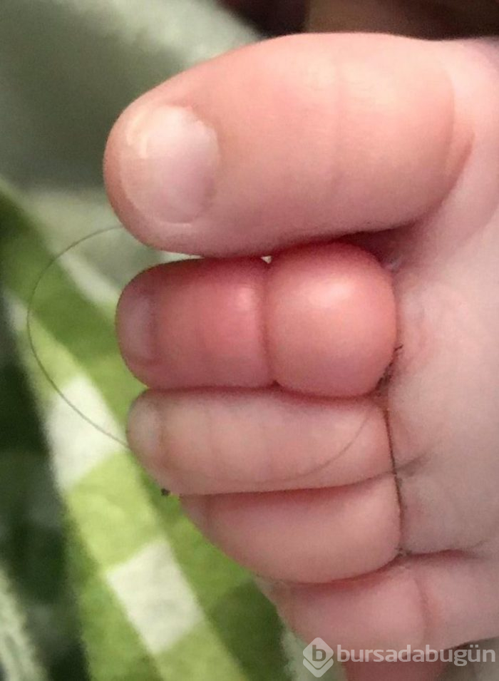 Aklınıza bile gelmez! Az daha parmağından oluyordu
