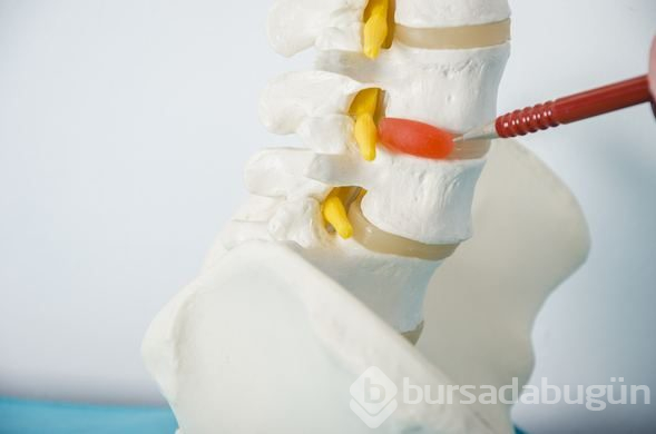 Boyun fıtığı hakkında doğru bilinen 7 yanlış
