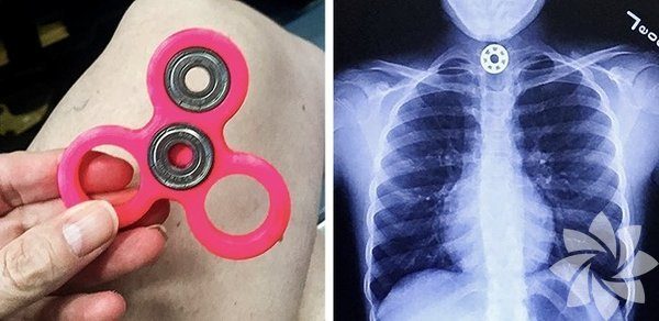 Çocuklar için tehlikeli olabilecek oyuncaklar
