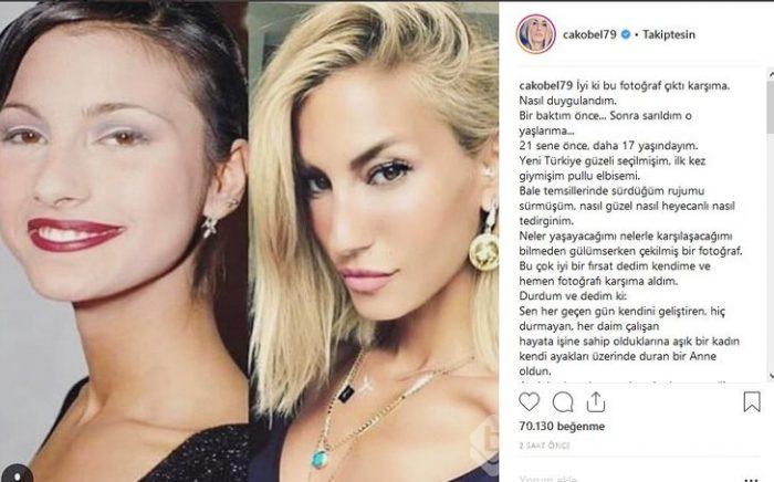 Yıllar önceki fotoğrafı ortaya çıktı! İnanılmaz fark
