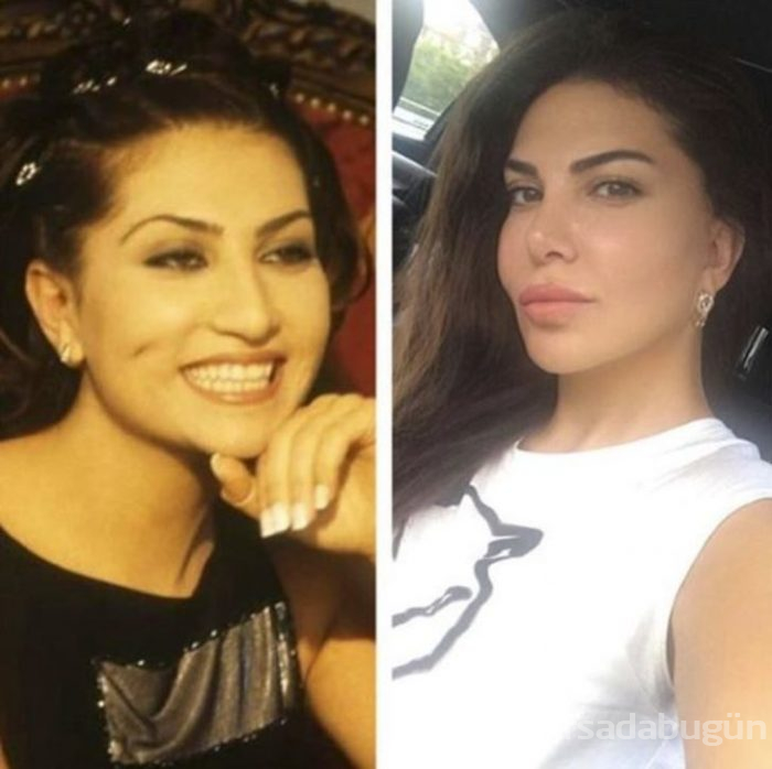 Yıllar önceki fotoğrafı ortaya çıktı! İnanılmaz fark
