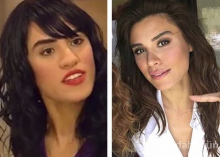 Yıllar önceki fotoğrafı ortaya çıktı! İnanılmaz fark
