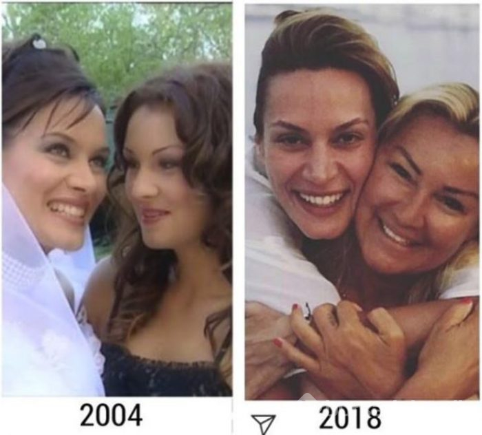 Yıllar önceki fotoğrafı ortaya çıktı! İnanılmaz fark
