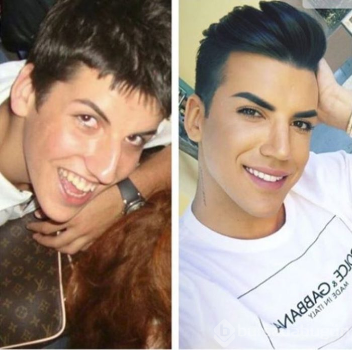 Yıllar önceki fotoğrafı ortaya çıktı! İnanılmaz fark
