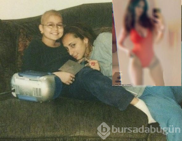 11 yaşında kanser oldu, bacağını aldılar! Şimdi markaların peşinden koştuğu bir model
