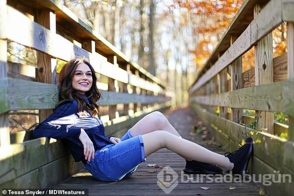 11 yaşında kanser oldu, bacağını aldılar! Şimdi markaların peşinden koştuğu bir model
