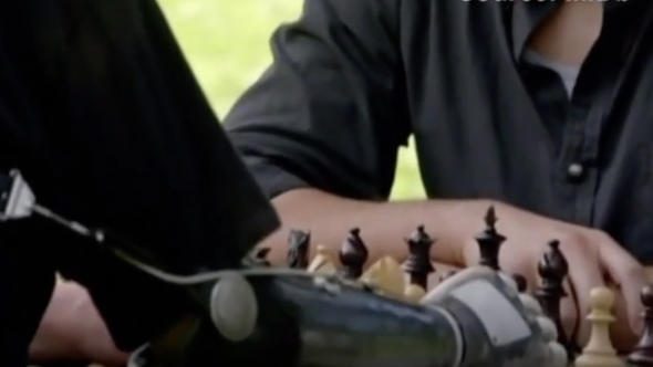 Filmlerde rol kapabilmek için kolunu kesti