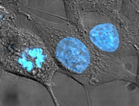Henrietta Lacks'in hücreleri ölümsüzlüğün şifresi olabilir
