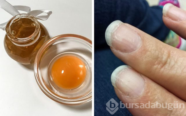Tırnakları güçlü ve sağlıklı hale getirmenin 10 doğal yolu
