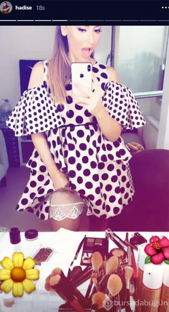 Hadise'den 'etek kaldırma' hareketi!
