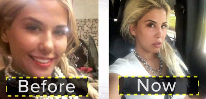 Sırf Ivanka Trump'a benzemek için defalarca bıçak altına yattı
