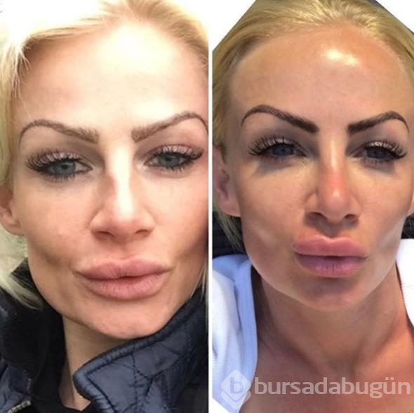 Ona benzemek uğruna bu hale geldi!
