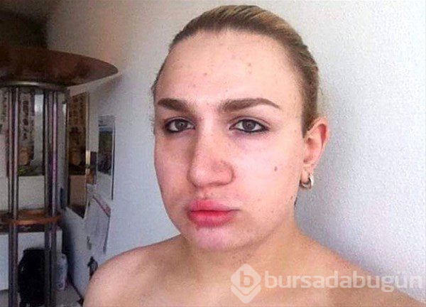 Trans birey barbie bebeğe benzemek için...
