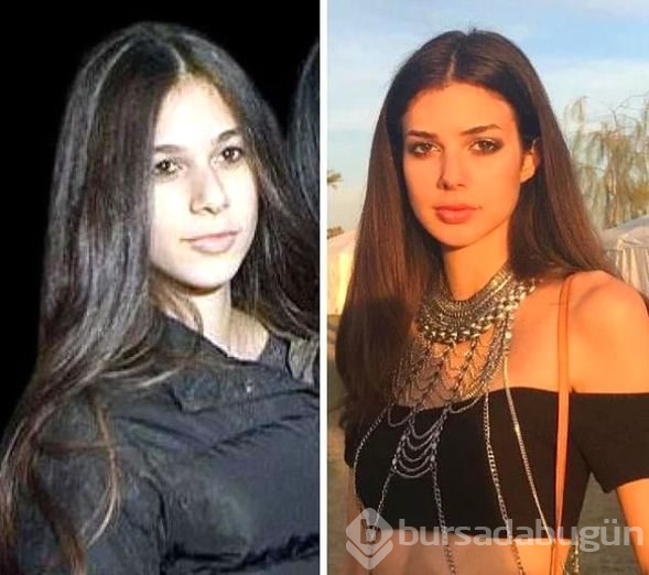 Hangi ünlüler estetik harikası?
