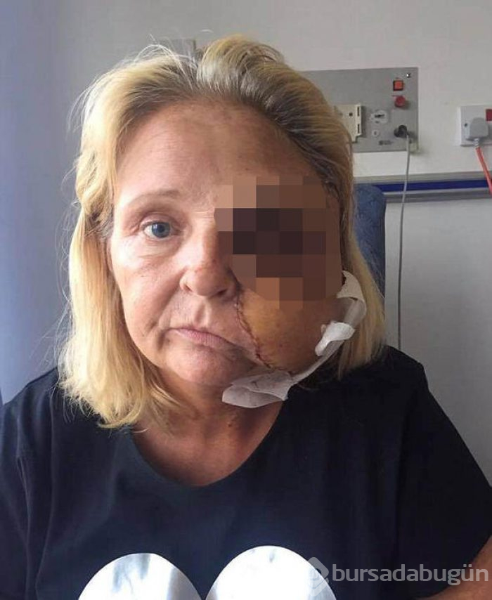 Et yiyen bakteri hayatını kabusa çevirdi

