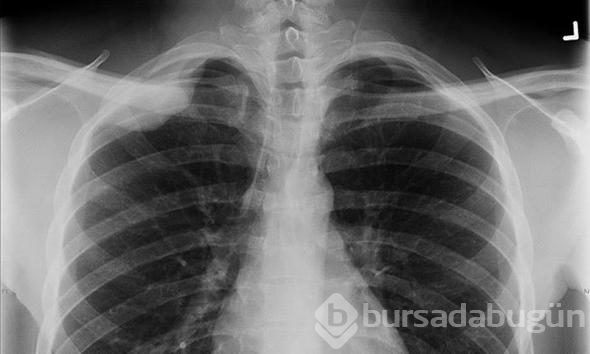 Son 150 yılda bulunan ve hayatımızı değiştiren buluşlar
