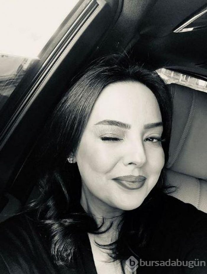 Ebru Gündeş köfte dudak modasına uydu
