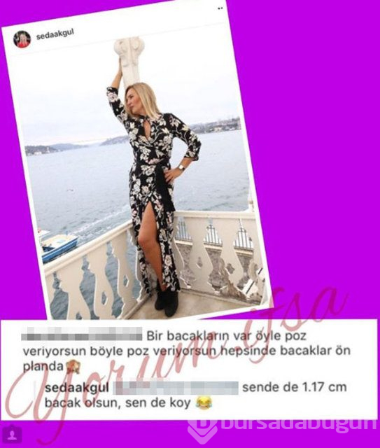 Seda Akgül: Sende de 117 cm bacak olsa...
