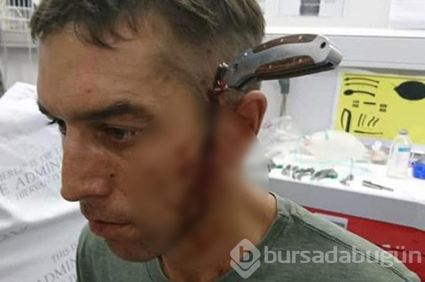 Koca bıçak başına saplandı! 