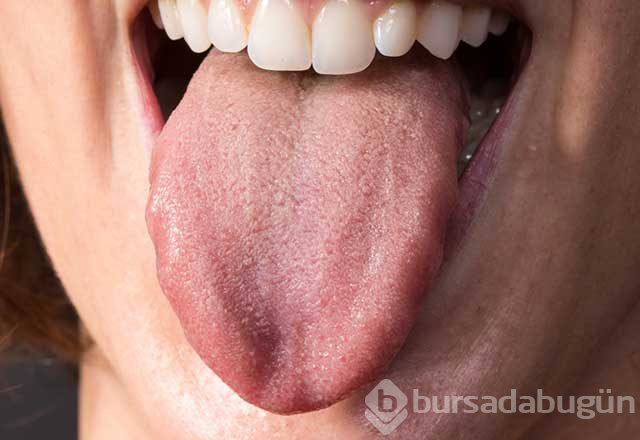 Dilinizin sağlığınız hakkında verdiği önemli ipuçları
