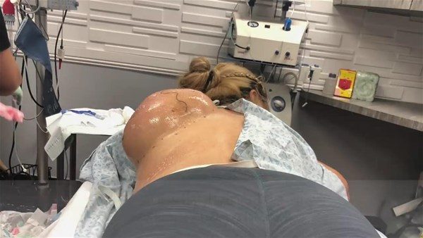 Sırtından çıkanlar şoke etti
