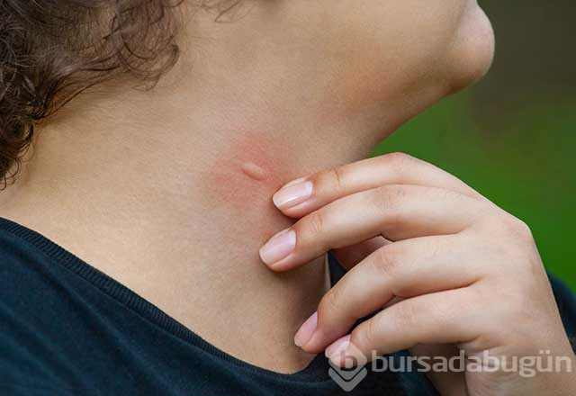 İnsanlar tarafından önemsenmeyen erken kanser belirtileri
