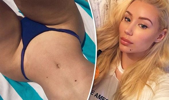 Iggy Azalea zayıfladı!
