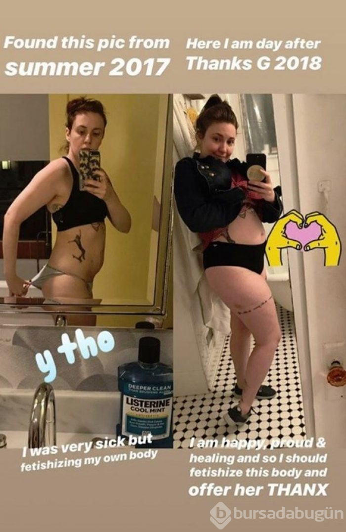 Lena Dunham öncesi-sonrası fotoğrafıyla ters köşe yaptı
