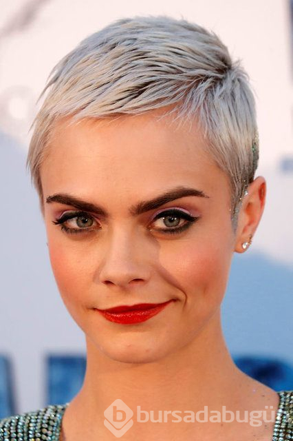 Cara Delevingne çekimde sakatlandı
