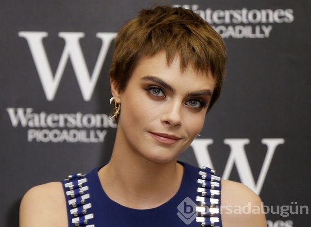 Cara Delevingne çekimde sakatlandı
