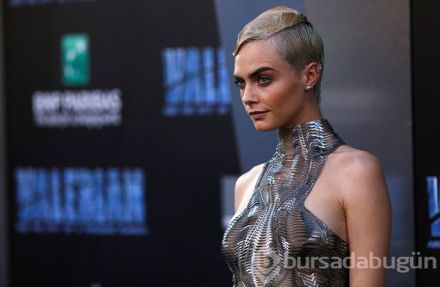 Cara Delevingne çekimde sakatlandı
