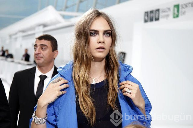 Cara Delevingne çekimde sakatlandı
