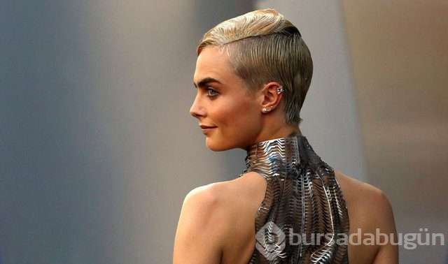 Cara Delevingne çekimde sakatlandı
