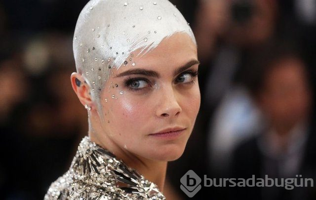Cara Delevingne çekimde sakatlandı
