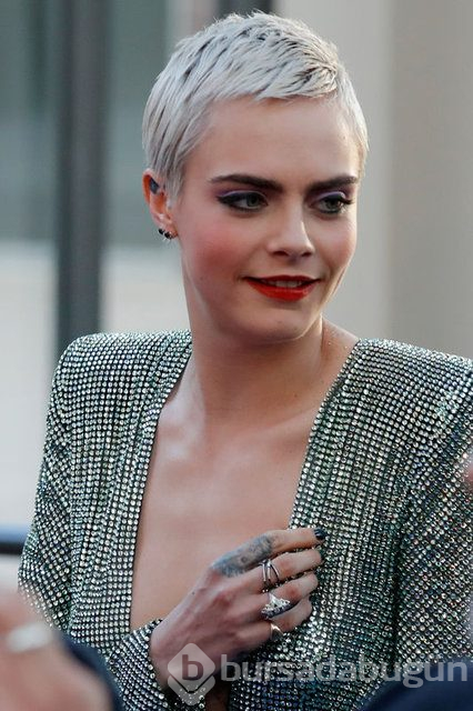 Cara Delevingne çekimde sakatlandı
