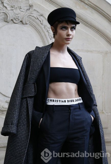 Cara Delevingne çekimde sakatlandı
