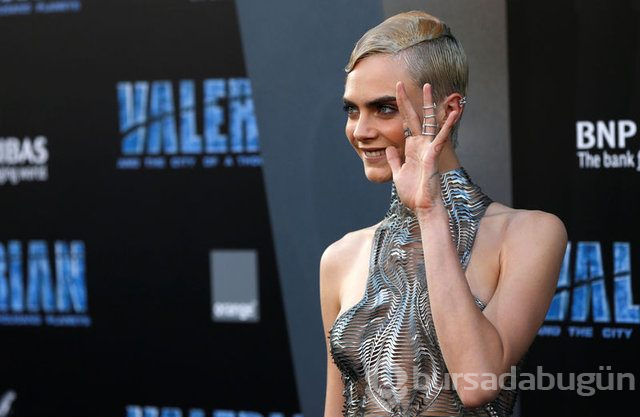 Cara Delevingne çekimde sakatlandı
