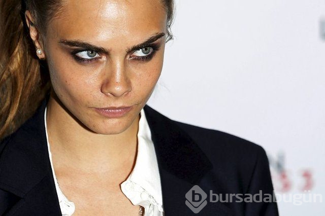 Cara Delevingne çekimde sakatlandı
