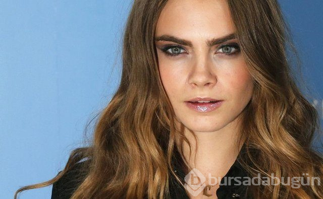 Cara Delevingne çekimde sakatlandı
