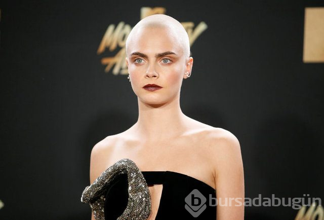 Cara Delevingne çekimde sakatlandı
