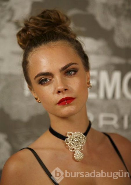 Cara Delevingne çekimde sakatlandı
