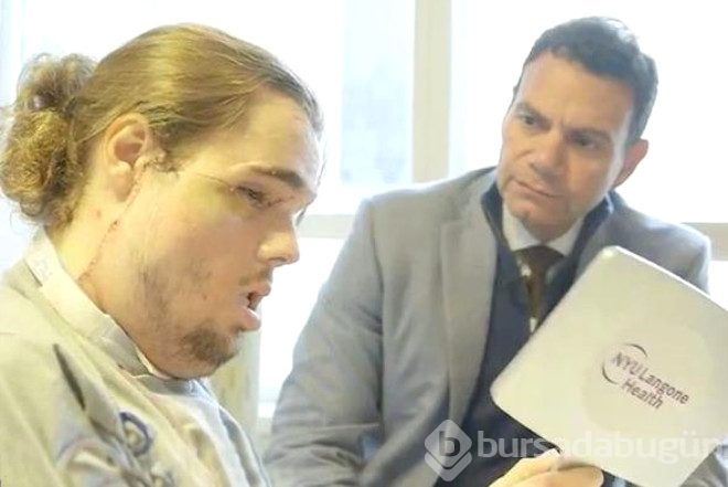 Kendini yüzünden vurup paramparça etmişti, yüz nakliyle hayata yeniden döndü

