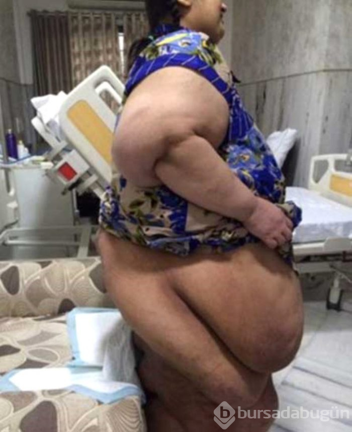 2 senede 175 kilo verdi! Şimdi bambaşka biri
