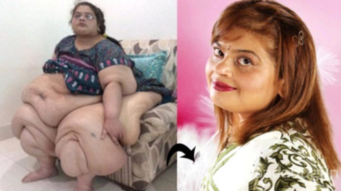 2 senede 175 kilo verdi! Şimdi bambaşka biri
